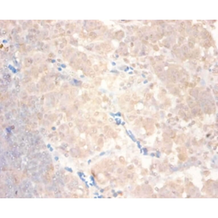 Immunohistochemistry - C-C motif chemokine 24 Polyclonal Antibody from Signalway Antibody (42444) - Antibodies.com