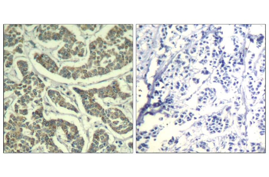 Immunohistochemistry - ATR (Ab-428) Antiobdy from Signalway Antibody (21505) - Antibodies.com