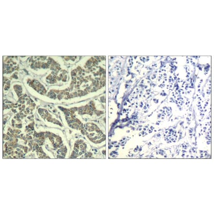 Immunohistochemistry - ATR (Ab-428) Antiobdy from Signalway Antibody (21505) - Antibodies.com