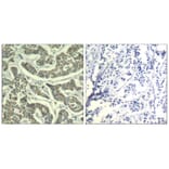 Immunohistochemistry - ATR (Ab-428) Antiobdy from Signalway Antibody (21505) - Antibodies.com