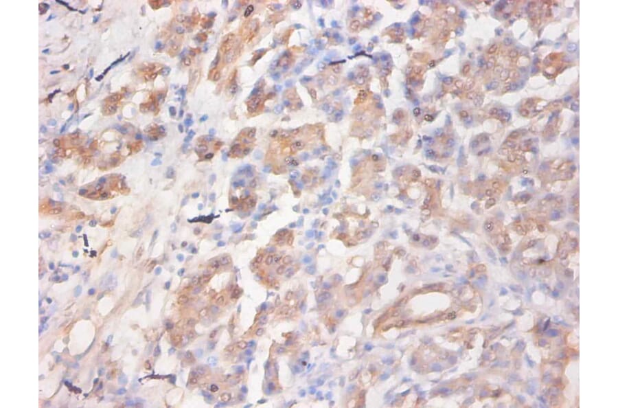 Immunohistochemistry - C-C motif chemokine 2 Monoclonal Antibody from Signalway Antibody (42032) - Antibodies.com