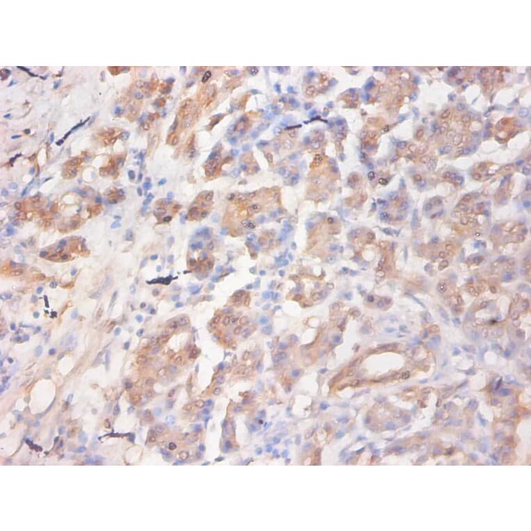 Immunohistochemistry - C-C motif chemokine 2 Monoclonal Antibody from Signalway Antibody (42032) - Antibodies.com