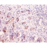 Immunohistochemistry - Alpha-galactosidase A Polyclonal Antibody from Signalway Antibody (42183) - Antibodies.com