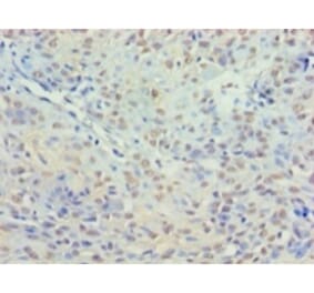 Immunohistochemistry - Histone deacetylase 3 Polyclonal Antibody from Signalway Antibody (42202) - Antibodies.com
