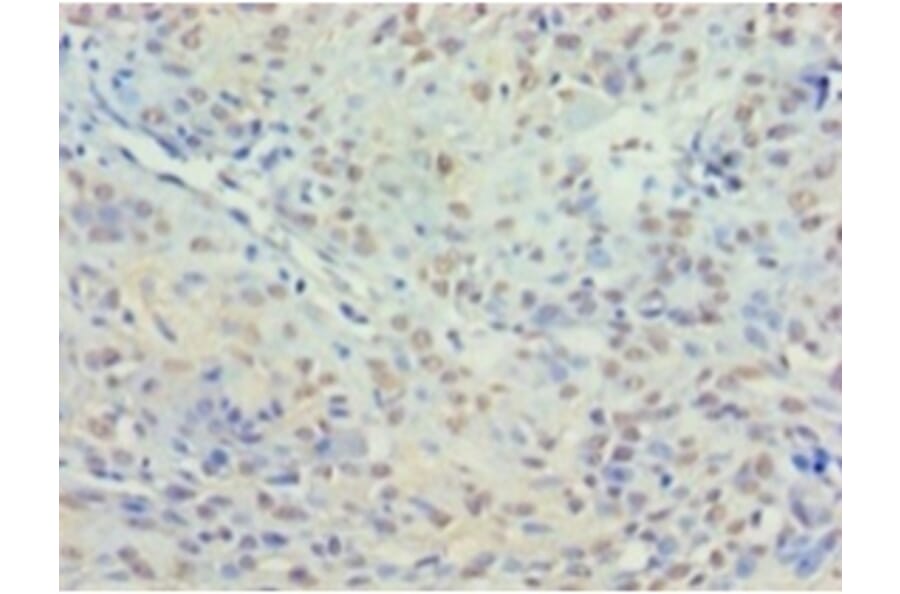 Immunohistochemistry - Histone deacetylase 3 Polyclonal Antibody from Signalway Antibody (42202) - Antibodies.com