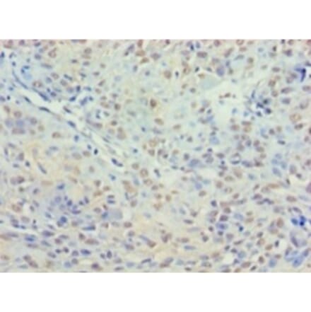 Immunohistochemistry - Histone deacetylase 3 Polyclonal Antibody from Signalway Antibody (42202) - Antibodies.com