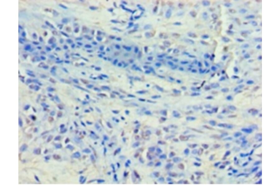 Immunohistochemistry - Histone deacetylase 8 Polyclonal Antibody from Signalway Antibody (42203) - Antibodies.com