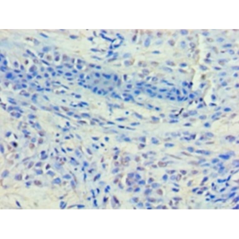 Immunohistochemistry - Histone deacetylase 8 Polyclonal Antibody from Signalway Antibody (42203) - Antibodies.com