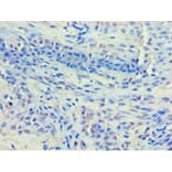 Immunohistochemistry - Histone deacetylase 8 Polyclonal Antibody from Signalway Antibody (42203) - Antibodies.com
