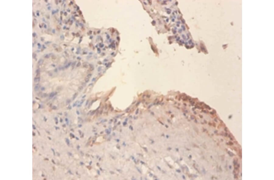 Immunohistochemistry - Phospholipid transfer Polyclonal Antibody from Signalway Antibody (42297) - Antibodies.com