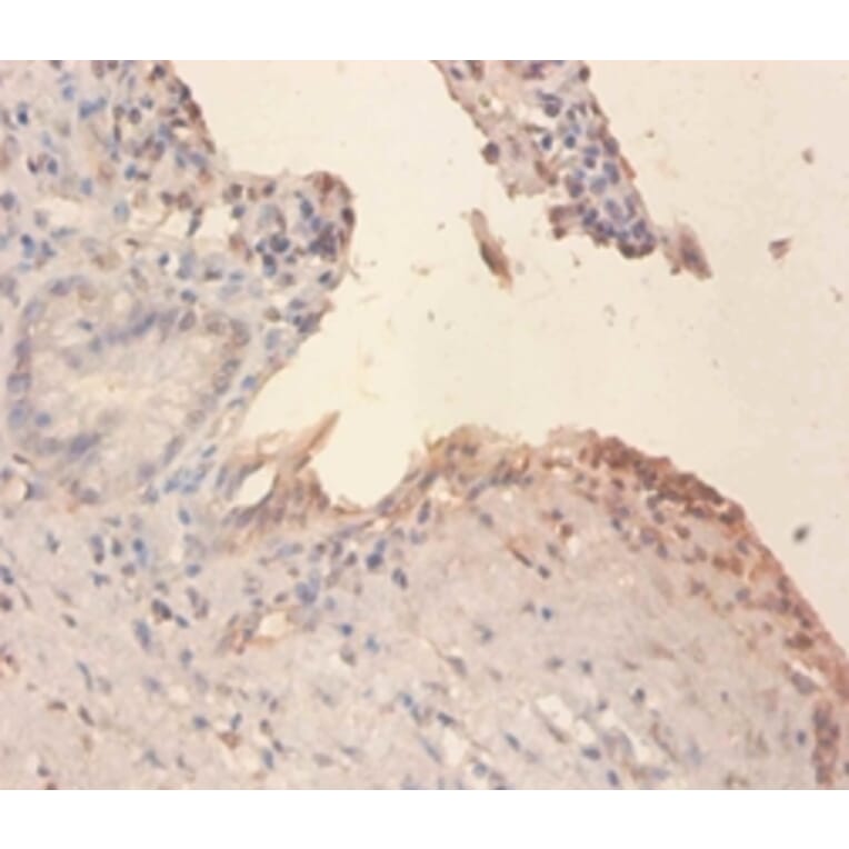 Immunohistochemistry - Phospholipid transfer Polyclonal Antibody from Signalway Antibody (42297) - Antibodies.com
