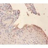 Immunohistochemistry - Phospholipid transfer Polyclonal Antibody from Signalway Antibody (42297) - Antibodies.com