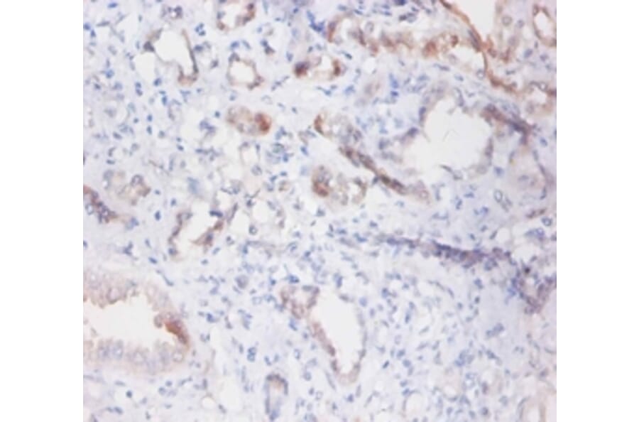 Immunohistochemistry - Phospholipid transfer Polyclonal Antibody from Signalway Antibody (42297) - Antibodies.com