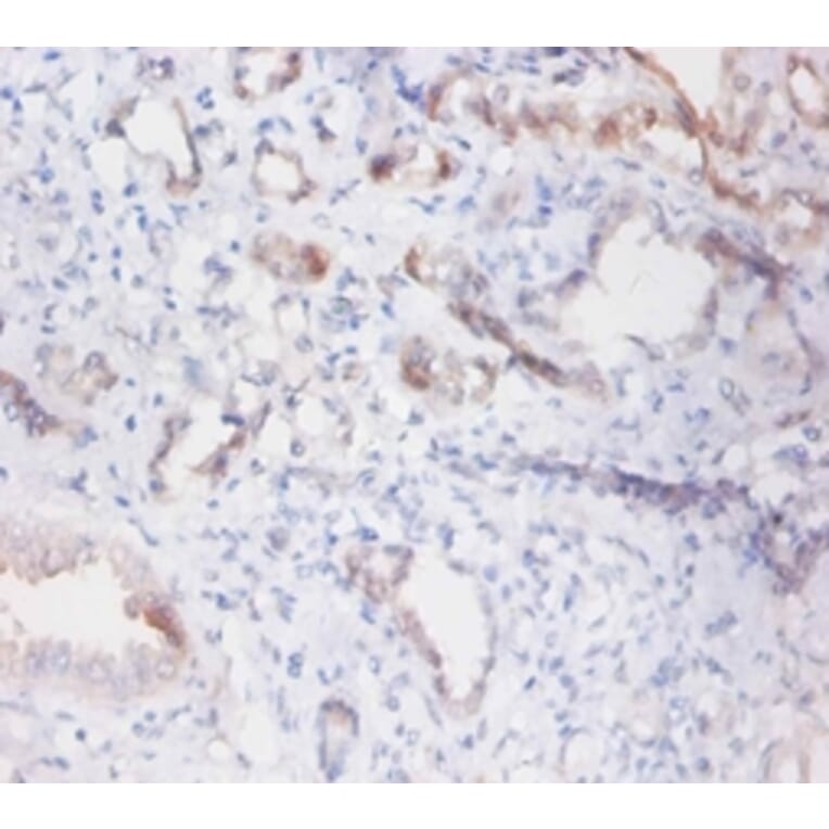 Immunohistochemistry - Phospholipid transfer Polyclonal Antibody from Signalway Antibody (42297) - Antibodies.com