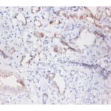Immunohistochemistry - Phospholipid transfer Polyclonal Antibody from Signalway Antibody (42297) - Antibodies.com