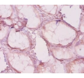 Immunohistochemistry - Histone deacetylase 4 Polyclonal Antibody from Signalway Antibody (42615) - Antibodies.com