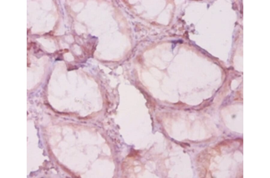 Immunohistochemistry - Histone deacetylase 4 Polyclonal Antibody from Signalway Antibody (42615) - Antibodies.com