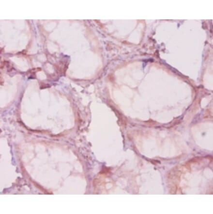 Immunohistochemistry - Histone deacetylase 4 Polyclonal Antibody from Signalway Antibody (42615) - Antibodies.com