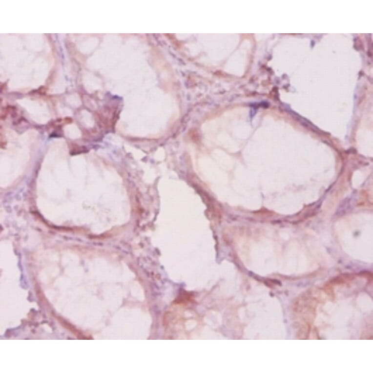 Immunohistochemistry - Histone deacetylase 4 Polyclonal Antibody from Signalway Antibody (42615) - Antibodies.com