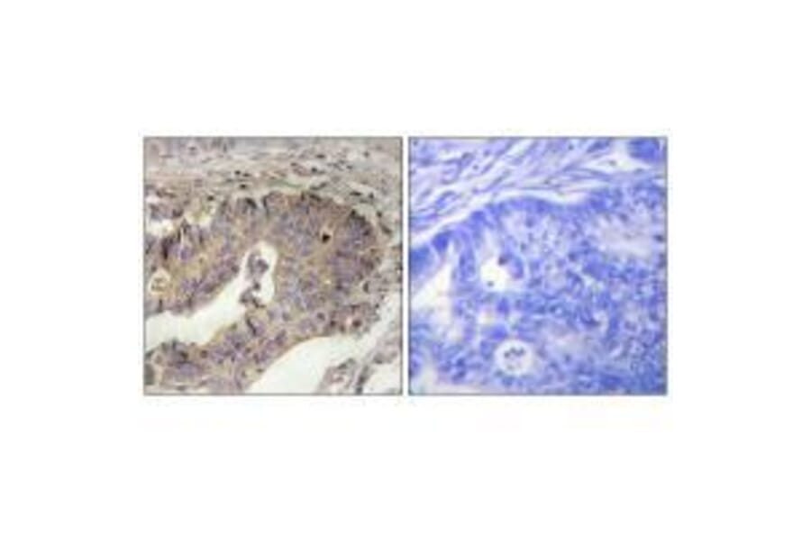 Immunohistochemistry - Fibrillin-1 Antibody from Signalway Antibody (33375) - Antibodies.com