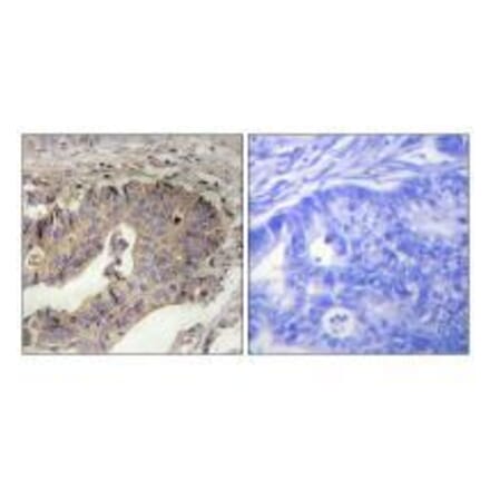 Immunohistochemistry - Fibrillin-1 Antibody from Signalway Antibody (33375) - Antibodies.com