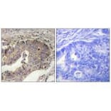 Immunohistochemistry - Fibrillin-1 Antibody from Signalway Antibody (33375) - Antibodies.com