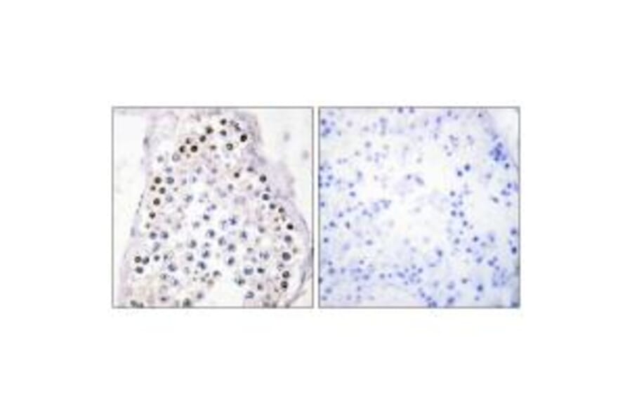 Immunohistochemistry - HOXA1/B1/D1 Antibody from Signalway Antibody (33681) - Antibodies.com