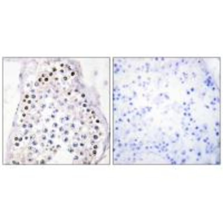 Immunohistochemistry - HOXA1/B1/D1 Antibody from Signalway Antibody (33681) - Antibodies.com