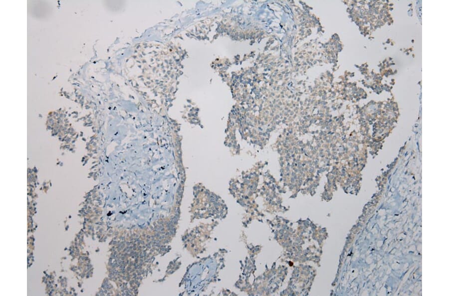 Immunohistochemistry - TSPY1/TSPY3 Antibody from Signalway Antibody (40394) - Antibodies.com