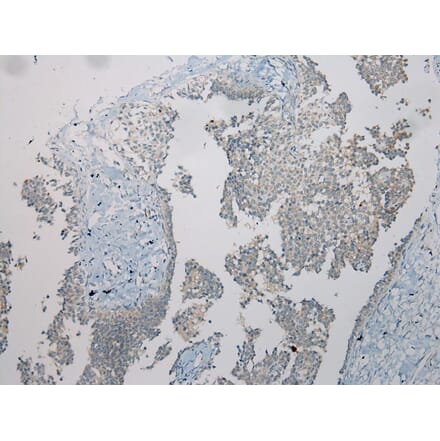 Immunohistochemistry - TSPY1/TSPY3 Antibody from Signalway Antibody (40394) - Antibodies.com