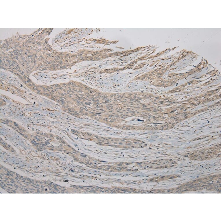 Immunohistochemistry - TSPY1/TSPY3 Antibody from Signalway Antibody (40394) - Antibodies.com