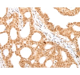Immunohistochemistry - CARM1/PRMT4 Antibody from Signalway Antibody (43100) - Antibodies.com