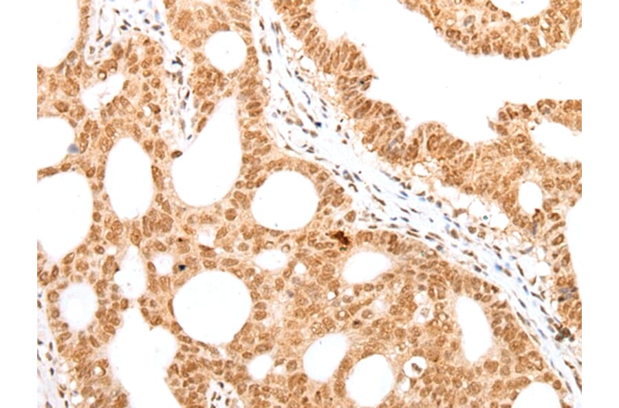 Immunohistochemistry - CARM1/PRMT4 Antibody from Signalway Antibody (43100) - Antibodies.com