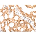 Immunohistochemistry - CARM1/PRMT4 Antibody from Signalway Antibody (43100) - Antibodies.com
