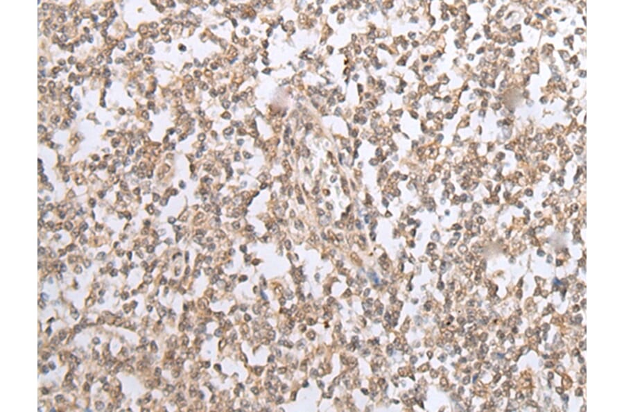 Immunohistochemistry - CARM1/PRMT4 Antibody from Signalway Antibody (43100) - Antibodies.com