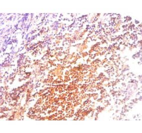 Immunohistochemistry - Beta-2-microglobulin Monoclonal Antibody from Signalway Antibody (42031) - Antibodies.com