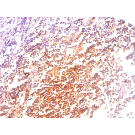Immunohistochemistry - Beta-2-microglobulin Monoclonal Antibody from Signalway Antibody (42031) - Antibodies.com