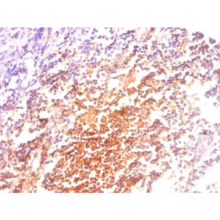 Immunohistochemistry - Beta-2-microglobulin Monoclonal Antibody from Signalway Antibody (42031) - Antibodies.com