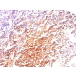 Immunohistochemistry - Beta-2-microglobulin Monoclonal Antibody from Signalway Antibody (42031) - Antibodies.com