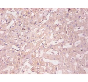 Immunohistochemistry - Ferritin light chain Monoclonal Antibody from Signalway Antibody (42045) - Antibodies.com