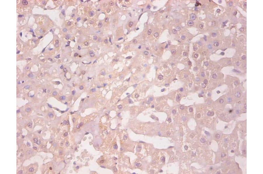 Immunohistochemistry - Ferritin light chain Monoclonal Antibody from Signalway Antibody (42045) - Antibodies.com