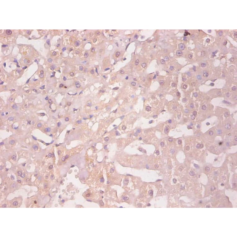 Immunohistochemistry - Ferritin light chain Monoclonal Antibody from Signalway Antibody (42045) - Antibodies.com