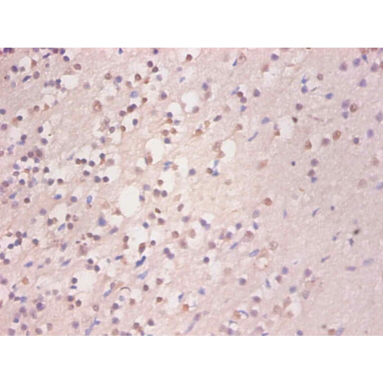 Immunohistochemistry - Ferritin light chain Monoclonal Antibody from Signalway Antibody (42045) - Antibodies.com