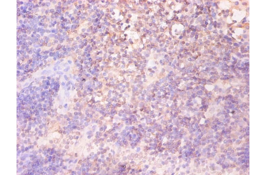 Immunohistochemistry - Ferritin light chain Monoclonal Antibody from Signalway Antibody (42045) - Antibodies.com