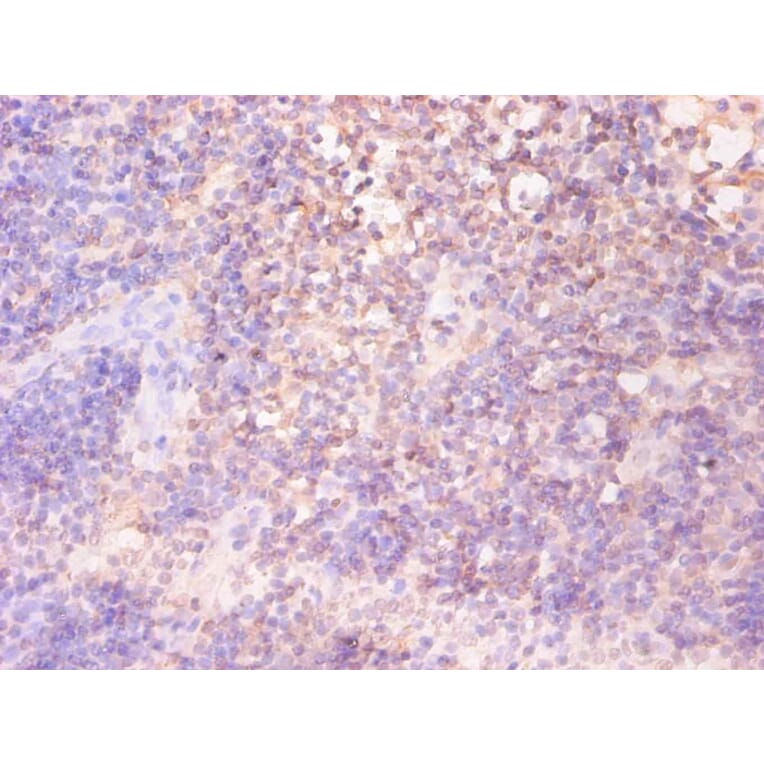 Immunohistochemistry - Ferritin light chain Monoclonal Antibody from Signalway Antibody (42045) - Antibodies.com