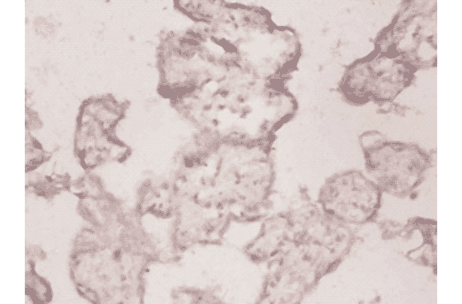 Immunohistochemistry - Toll-like receptor 7 Polyclonal Antibody from Signalway Antibody (42344) - Antibodies.com