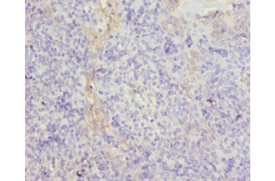 Immunohistochemistry - Tubulin beta chain A Polyclonal Antibody from Signalway Antibody (42360) - Antibodies.com