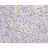 Immunohistochemistry - Tubulin beta chain A Polyclonal Antibody from Signalway Antibody (42360) - Antibodies.com