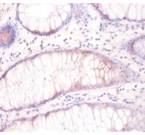 Immunohistochemistry - Tubulin beta-3 chain Polyclonal Antibody from Signalway Antibody (42404) - Antibodies.com