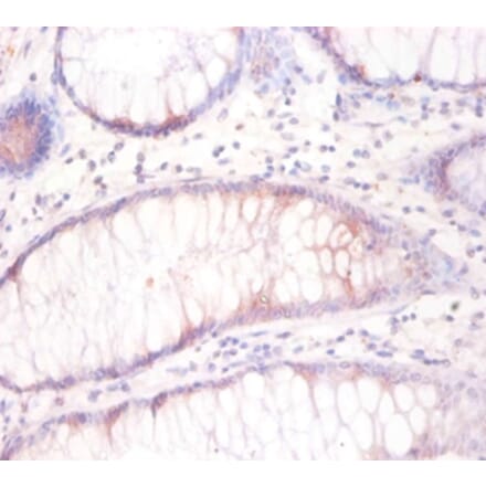 Immunohistochemistry - Tubulin beta-3 chain Polyclonal Antibody from Signalway Antibody (42404) - Antibodies.com